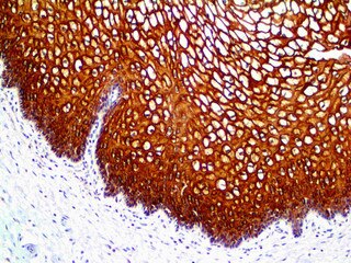 IHC of Cytokeratin 13 on an FFPE Cervix Tissue